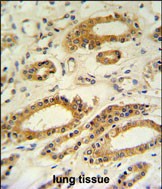 14 - DDO Antibody (Center) AP4795c