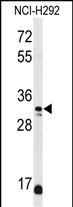 1 - DDO Antibody (Center) AP4795c