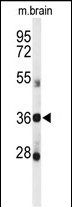 1 - DDO Antibody (Center) AP4795c