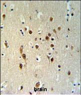 14 - TOX3 Antibody (Center) AP4814c
