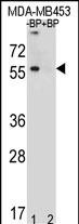 1 - TOX3 Antibody (Center) AP4814c