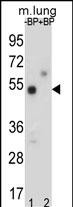 1 - TOX3 Antibody (Center) AP4814c