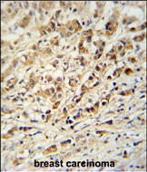 14 - AVL9 Antibody  (C-term) AP4844b