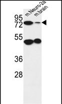 1 - AVL9 Antibody  (C-term) AP4844b