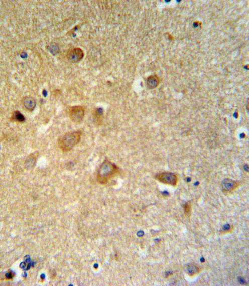 14 - GTSE1 Antibody (C-term) AP9882B
