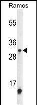 1 - METTL1 Antibody (Center) AP9887c
