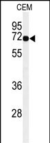 1 - MFSD6 Antibody  (C-term) AP9932b