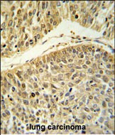 14 - RERE Antibody (N-term) AP9954A