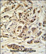 14 - M11D1 Antibody  (N-term) AP9974a