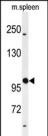 1 - GALNT5 Antibody (N-term) AP9976a