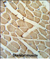14 - YTHD3 Antibody (Center) AP9985A