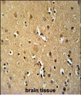 14 - TNFRSF8-Y479 Antibody AP4912d