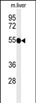 1 - TNFRSF8-Y479 Antibody AP4912d