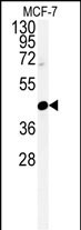 1 - CENPN Antibody (C-term) AP4913b