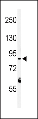1 - LRRN3 Antibody (N-term) AP4916A