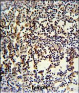 14 - ANR49 Antibody  (Center) AP4966c