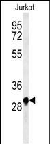 1 - ANR49 Antibody  (Center) AP4966c