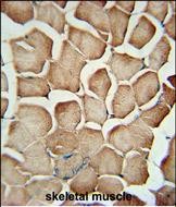 14 - AP1S1 Antibody (N-Term) AP5009a