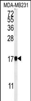 1 - AP1S1 Antibody (N-Term) AP5009a