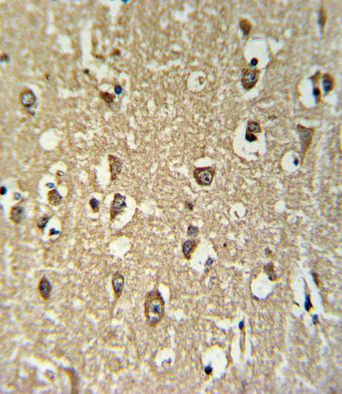 14 - CHRNA3 Antibody (N-term) AP5022A