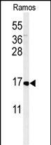 1 - CMTM7 Antibody (N-term) AP5023a
