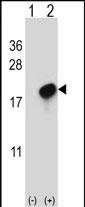 1 - CMTM7 Antibody (N-term) AP5023a