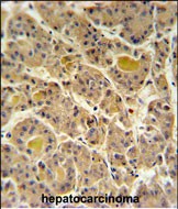 14 - IN80D Antibody  (N-term) AP5043a