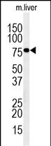 1 - IN80D Antibody  (N-term) AP5043a