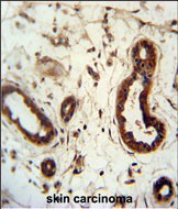 14 - KRT82 Antibody (Center) AP5049c
