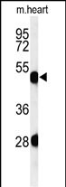 1 - KRT82 Antibody (Center) AP5049c