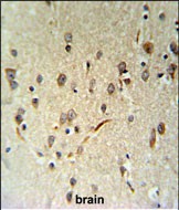14 - LIMD2 Antibody (N-term) AP5051a
