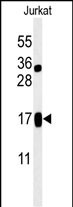 1 - LIMD2 Antibody (N-term) AP5051a