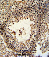 14 - PHF13 Antibody (C-term) AP5064b