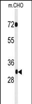 1 - PHF13 Antibody (C-term) AP5064b
