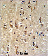 14 - SGTB Antibody (N-term) AP5076A