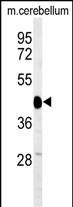 1 - SGTB Antibody (N-term) AP5076A