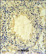 14 - UBXN6 Antibody  (C-term) AP5085b