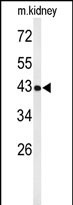 1 - UBXN6 Antibody  (C-term) AP5085b