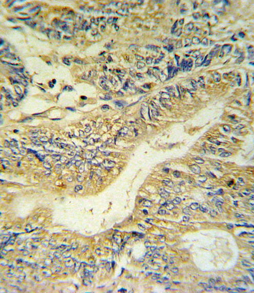 14 - PYY Antibody (C-term) AP5103B