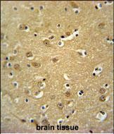14 - JHDM1D Antibody (Center) AP5116c
