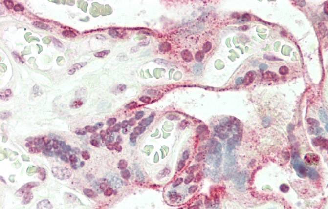 14 - JHDM1D Antibody (Center) AP5116c