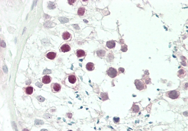 14 - JHDM1D Antibody (Center) AP5116c