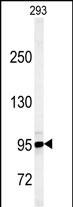 1 - JHDM1D Antibody (Center) AP5116c