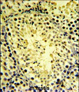 14 - DGKK Antibody (C-term) AP5122b