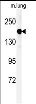 1 - DGKK Antibody (C-term) AP5122b