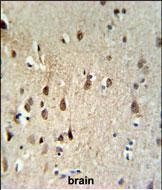 14 - HEL308 Antibody (Center) AP5124c