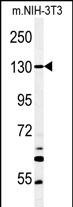 1 - HEL308 Antibody (Center) AP5124c