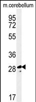 1 - TESC Antibody (C-term) AP5136b