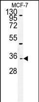 1 - TTPAL Antibody (C-term) AP5164b
