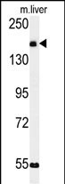 1 - KIAA1529 Antibody (C-term) AP5165b